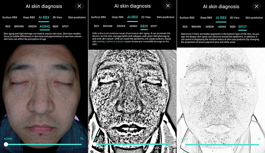 Perché sempre più centri estetici utilizzano Skin Analyser?