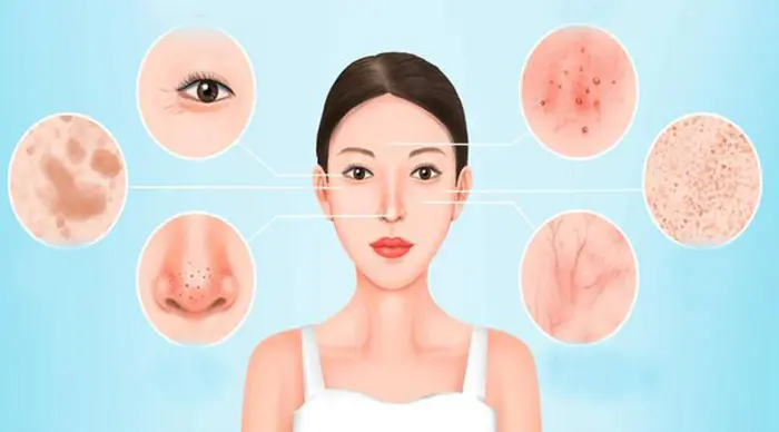 Intense Pulsed Light Photorejuvenation