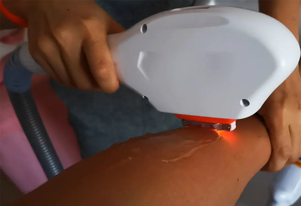 Intense Pulsed Light Device