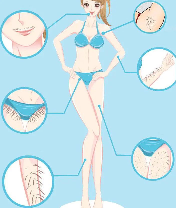 Intense Pulsed Light Laser Hair Removal