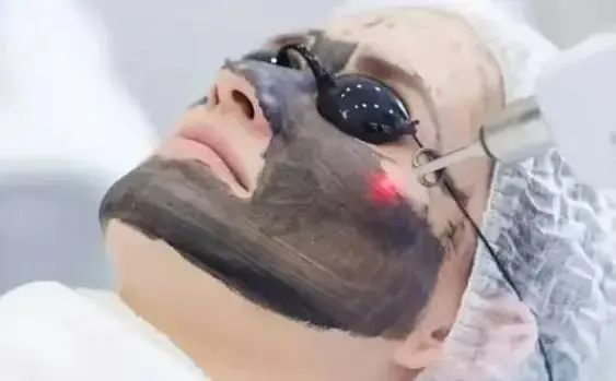 Intense Pulse Laser Hair Removal
