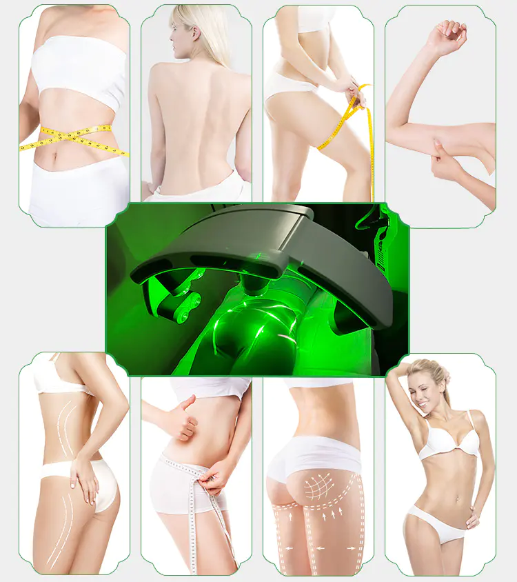 Laser Fat Loss