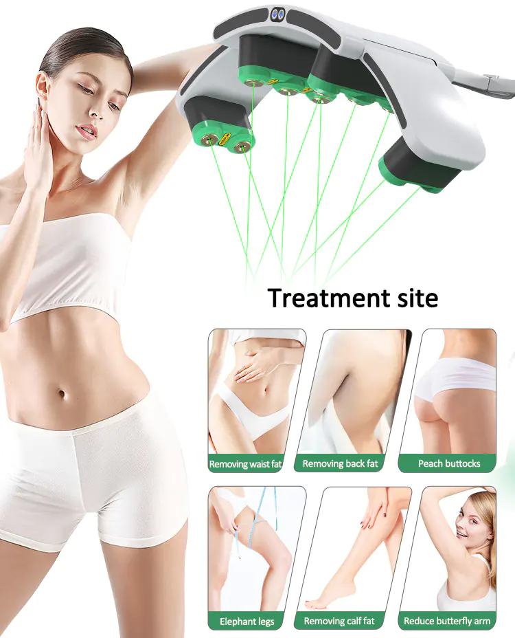 Laser Treatment for Weight Loss
