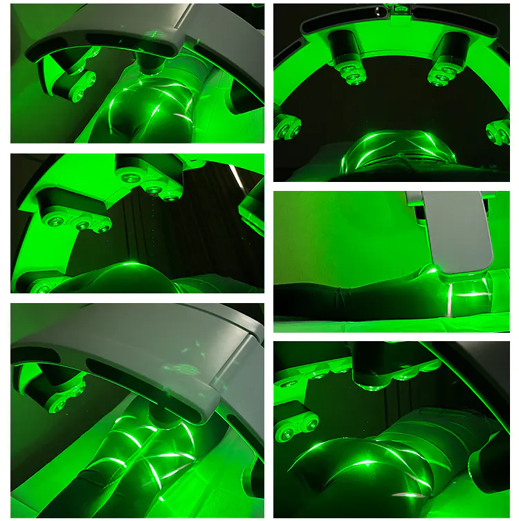Laser Treatment for Fat Loss