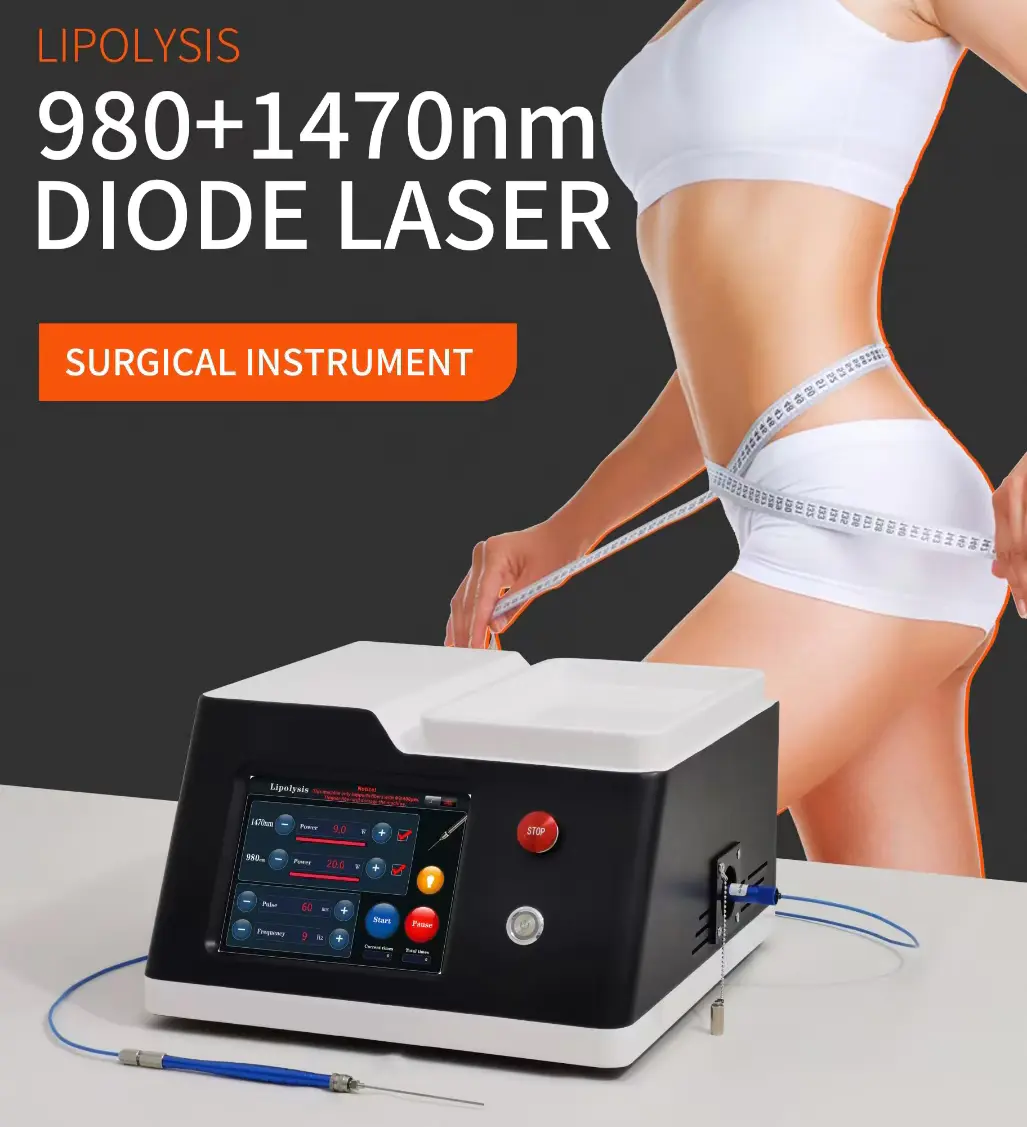 Laser Lipolysis