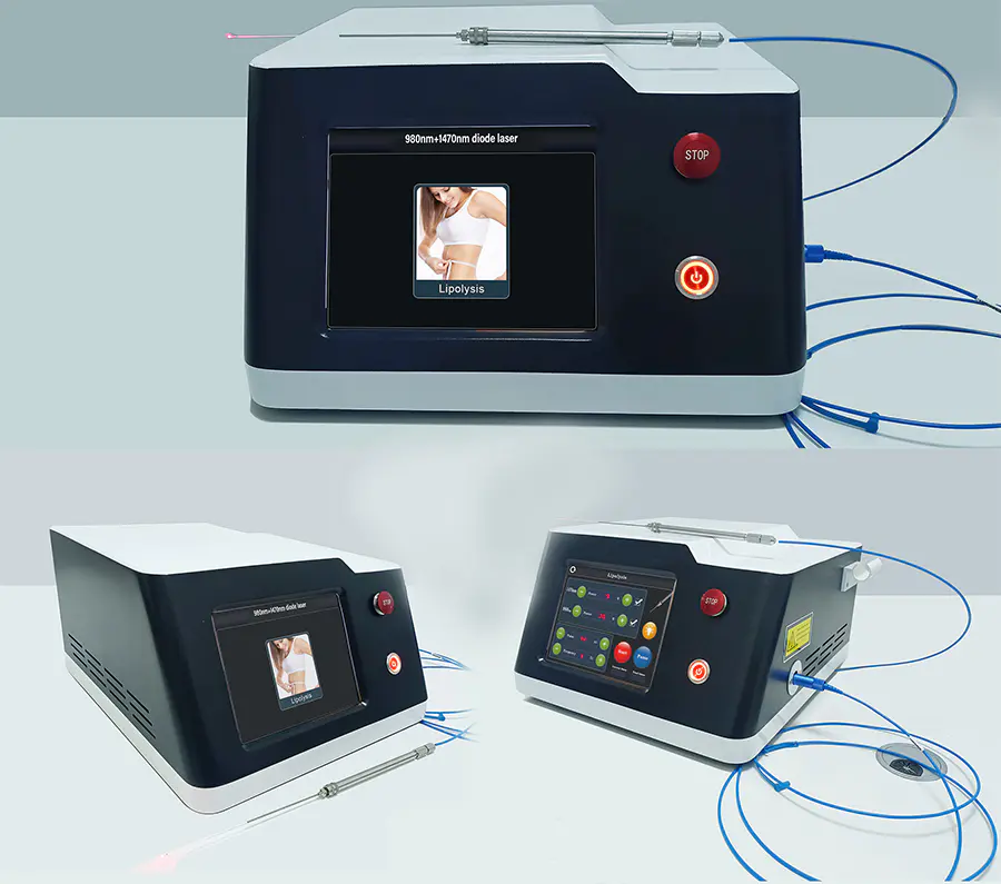 Laser Assisted Lipolysis