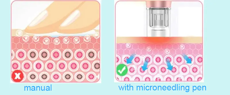 Dr Pen Microneedling Pen