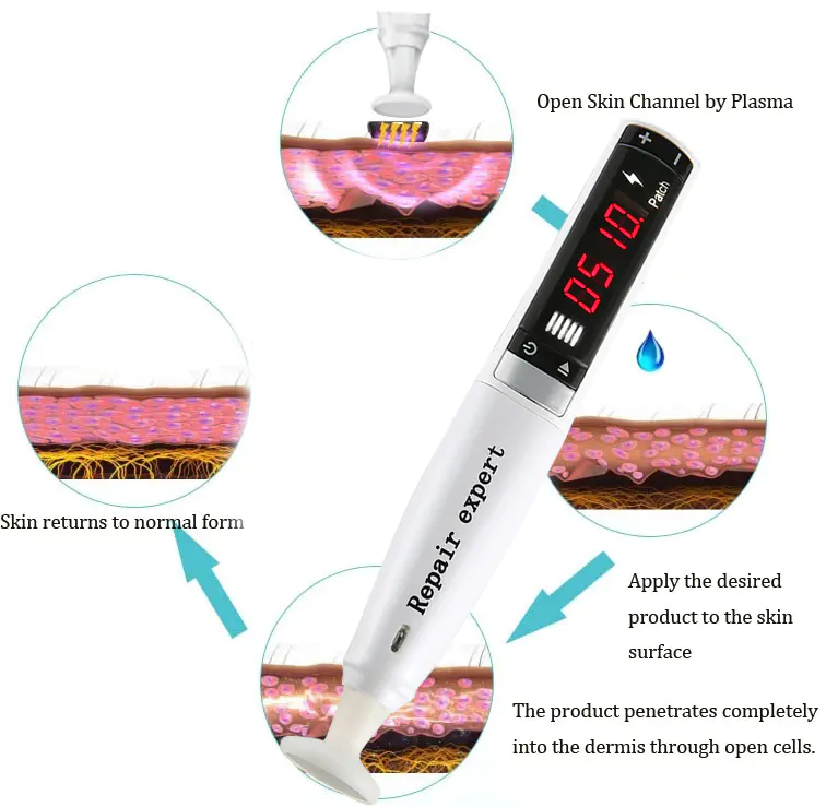 Plasma Skin Tightening