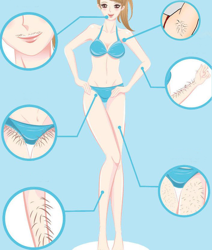 laser hair removal