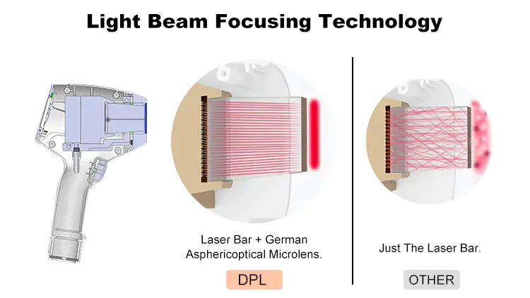 Best Hair Removal Laser