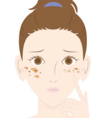 Skin Care Analyzer