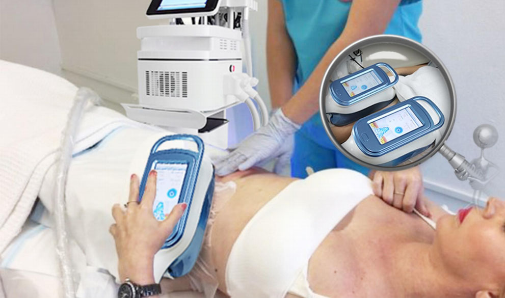 Cryolipolysis Machine