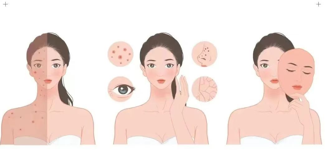 co2 facial