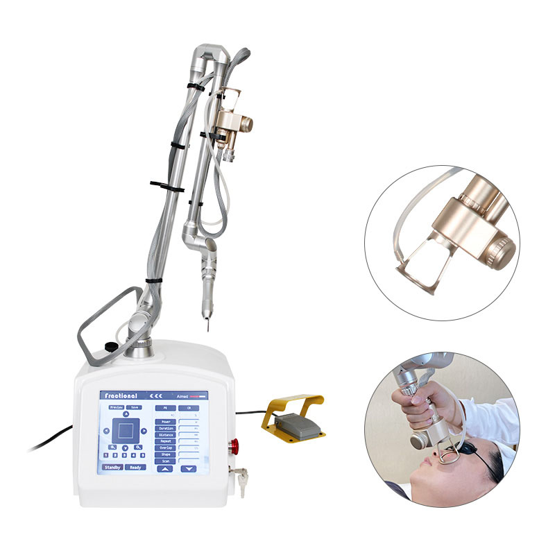 Macchina per la rimozione della cicatrice laser